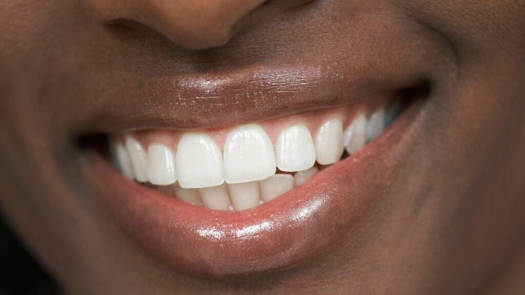 Coffee or Wine Staining Your Pearly Whites? A Dentist Offers Teeth Tips to Prevent This